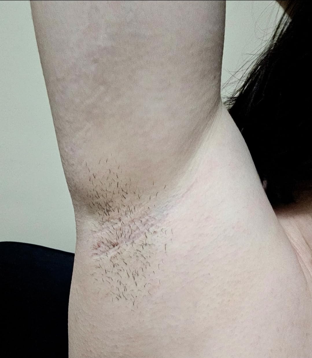 Philips Lumea 8000 Series IPL Hair Removal Device, Permanent Laser Hair Reduction for Women & Men, Easy and Comfortable Use at Home, SenseIQ, 3 Attachments for Body, Face, Intimate, BRI937/03 customer photo 2