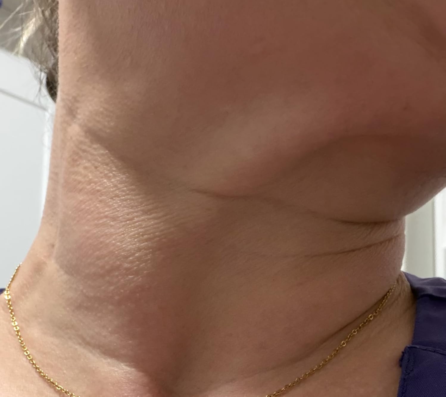 INIA 7-in-1 Red Light Therapy for Face and Neck Gua Sha Facial Massager Tool Device with Thermal and Cryo Mode for Puffiness & Firming Skincare Tool customer photo 2