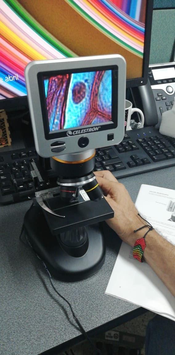 Celestron TetraView LCD Digital Microscope - Biological Microscope with Built-in 5MP Digital Camera, Adjustable Mechanical Stage, Carrying Case and 2GB Micro SD Card customer photo 1