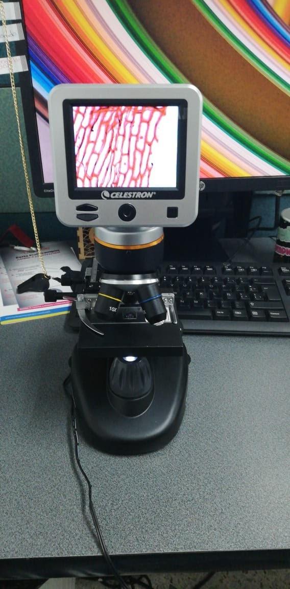 Celestron TetraView LCD Digital Microscope - Biological Microscope with Built-in 5MP Digital Camera, Adjustable Mechanical Stage, Carrying Case and 2GB Micro SD Card customer photo 2
