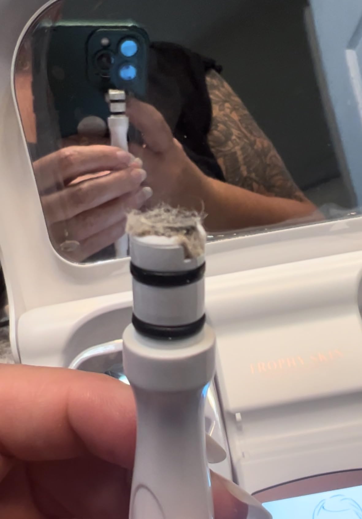 Trophy Skin MicrodermMD - At Home Microdermabrasion Kit - Anti Aging and Acne Treatment - Contains Real Diamond and Pore Extractor Tips to Rejuvenate Skin customer photo 1