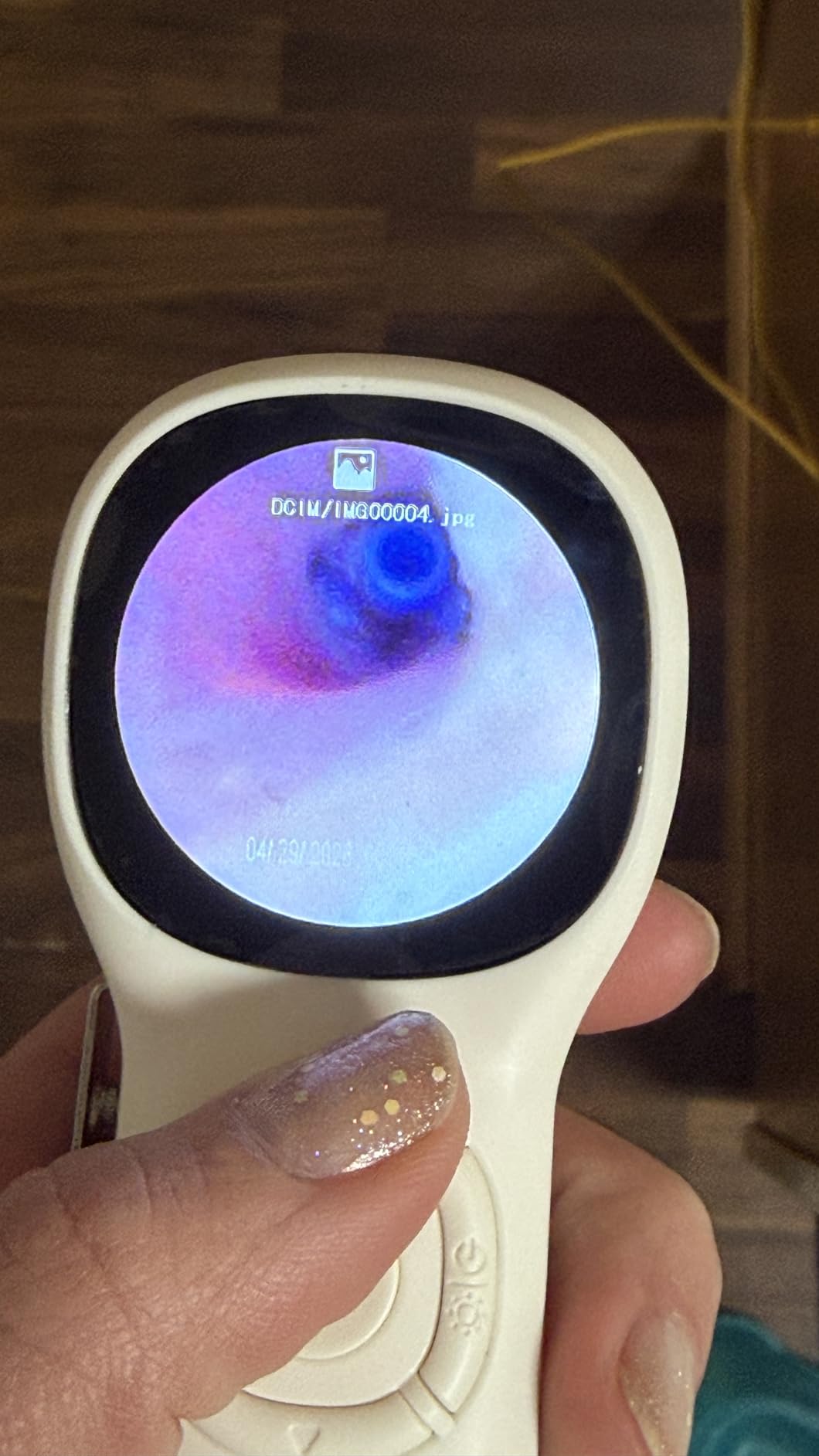 ScopeAround Digital Otoscope w/Built-in Screen, Manual-Focus Digital Otoscope with Light for Home Use, No App Needed, Easy Viewing for Everyday Ear Checks, Otoscope Camera, White customer photo 2