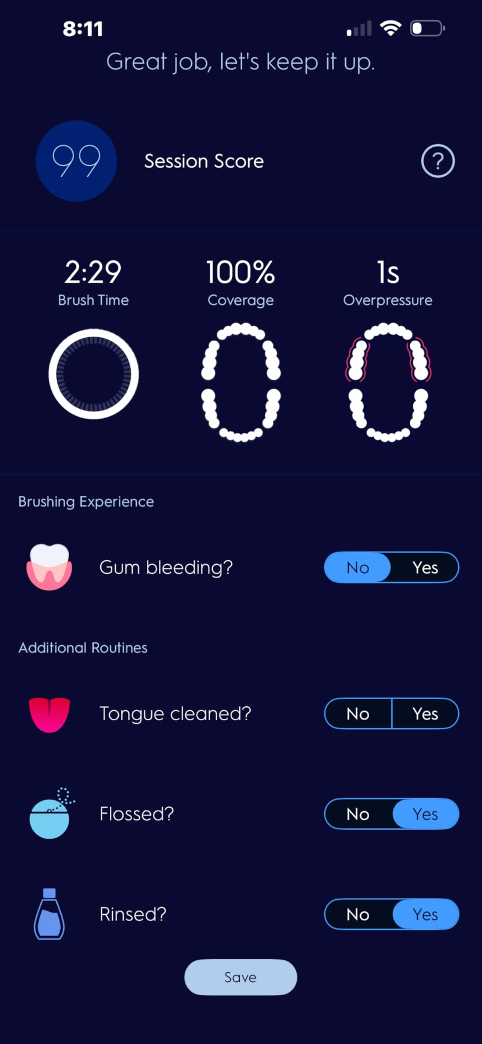 Oral-B Genius X Limited Rechargeable Electric Toothbrush with 1 Replacement Brush Head, Travel Case, Midnight Black customer photo 2