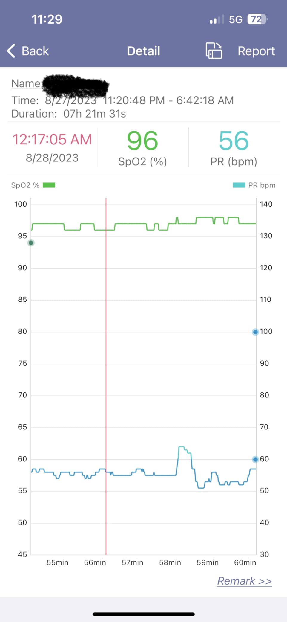 SleepO2 Wrist Pulse Oximeter with Recording Capability | Sleep Pulse Oximeter for Blood Oxygen Saturation Tracking Continuously | Provides Sleep Report and Raw Data customer photo 2