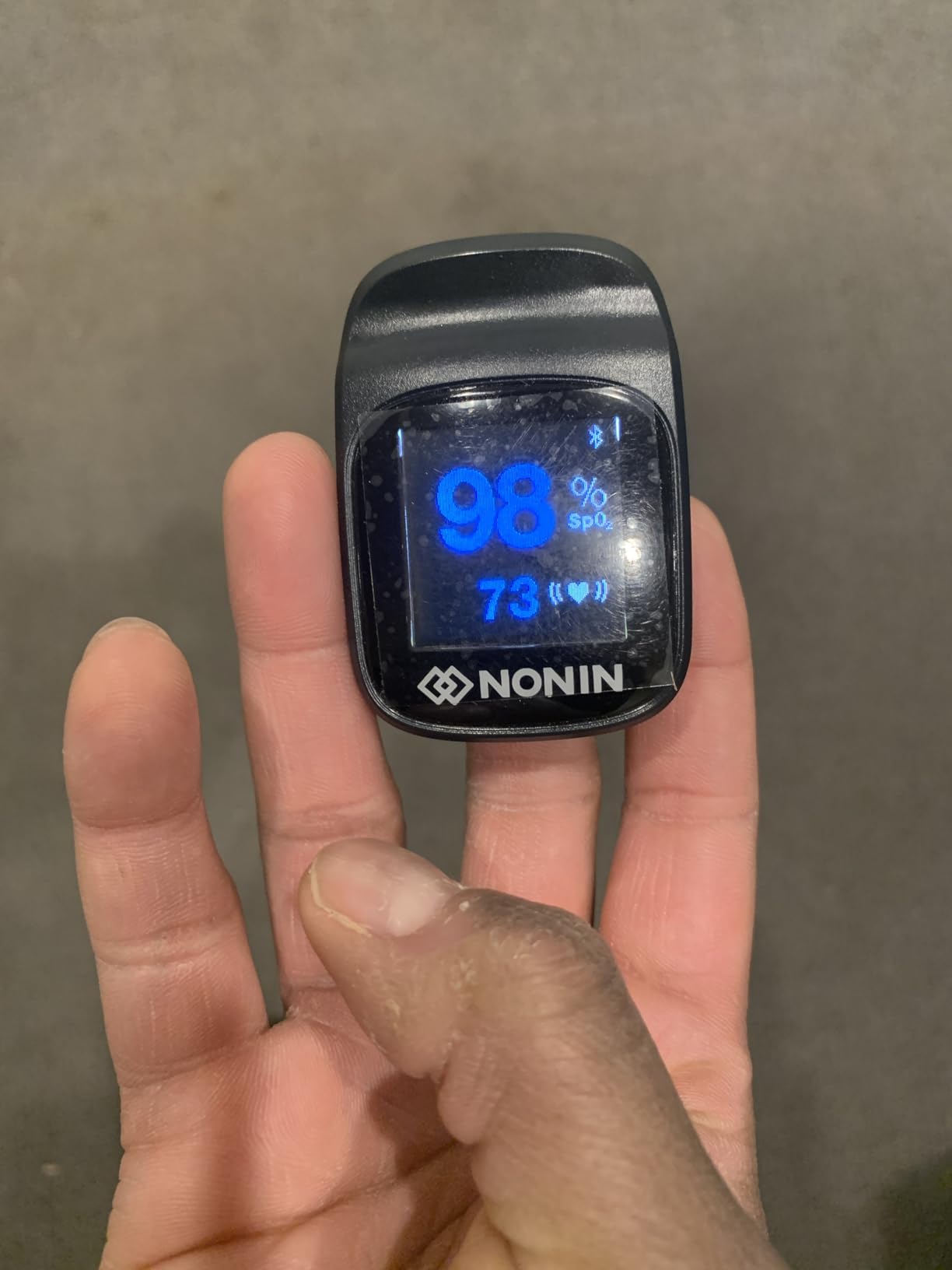 Nonin TruO2 OTC Pulse Oximeter 3250 customer photo 1