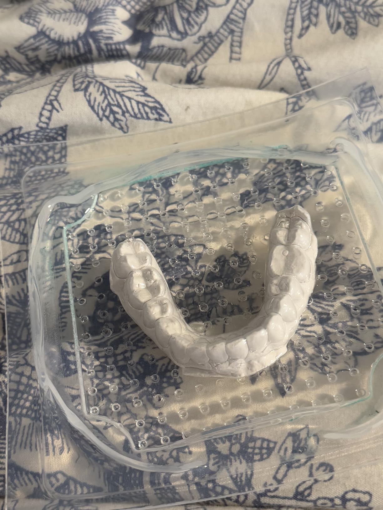 Laboratory Dental Vacuum Forming Molding 110V Machine Lab Maquina Ferulas dentQ customer photo 2