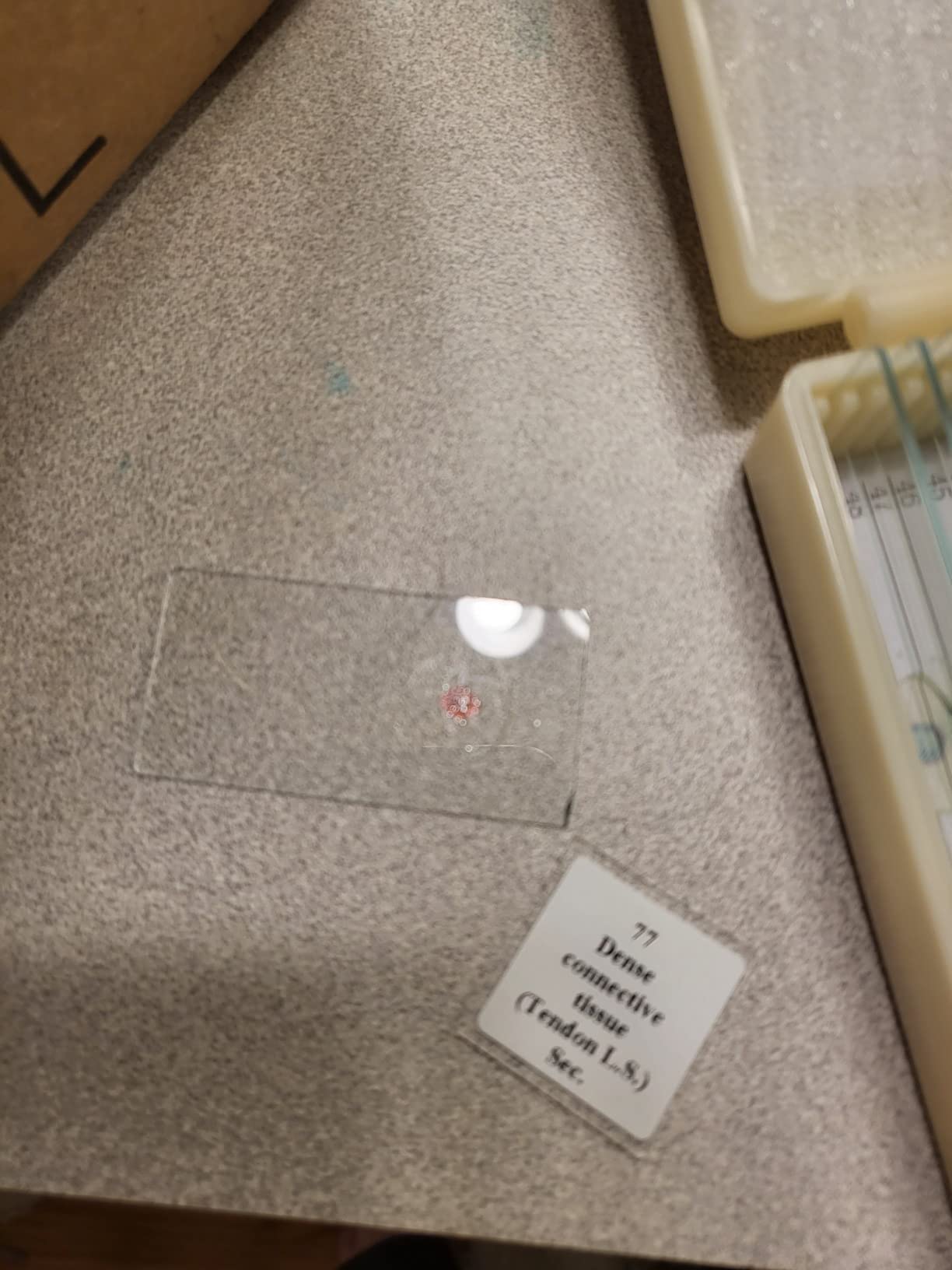 100 Prepared Microscope Slides with Specimens for Kids Adults - Bacterium, Fungus, Human Tissues, Mitosis, Plants, Insects, Animals Cells Samples for Biological Science Lab, School Students customer photo 1