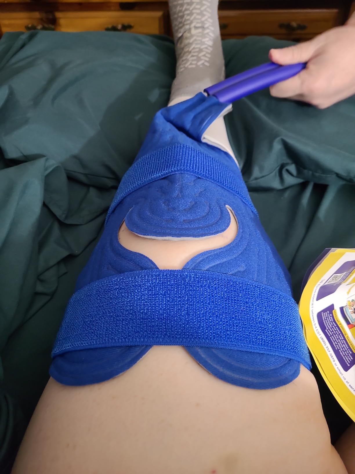 Brace Direct BlueIce Cold Therapy Machine – Cryotherapy for Pain Relief – Ice Machine for Knee After Surgery, Back, Shoulder, Hip, and Ankle – Cold Compression for Arthritis and Post-Surgery Relief customer photo 1