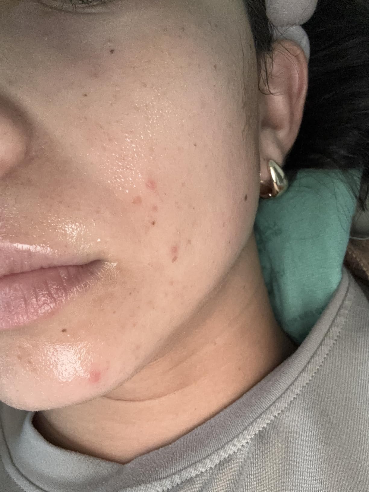 medicube Wrapping Mask Collagen - Overnight Peel Off Facial Mask customer photo 1